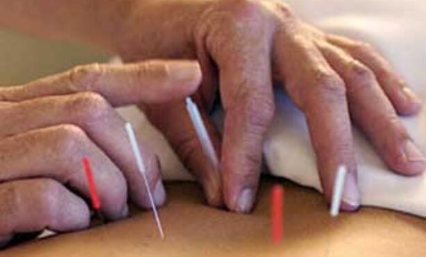 Amec Acupuntura Médica de Curitiba - Foto 1