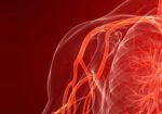 angiologia-curitiba-1418068066