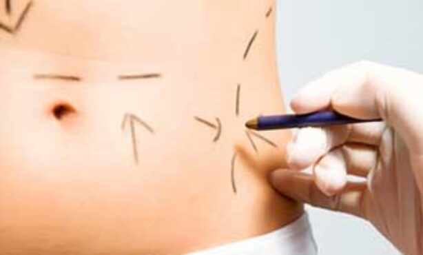 A D Cirurgia Plástica - Foto 1