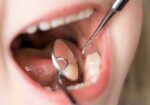odontopediatria-curitiba-1418128288