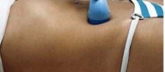 ultra-som-curitiba-1418133671